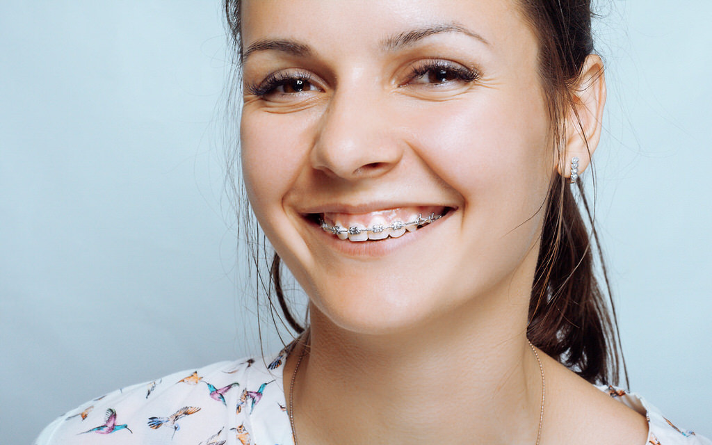 Kieferortopädie Brackets